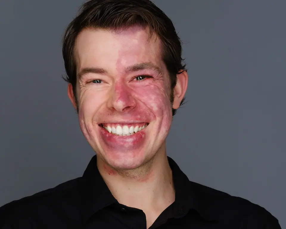 Joyful headshot of a man with a big smile in a black shirt